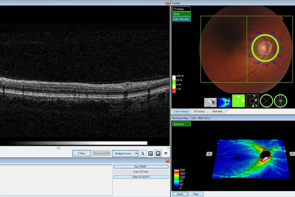 Optometrist reviewing scans with a patient